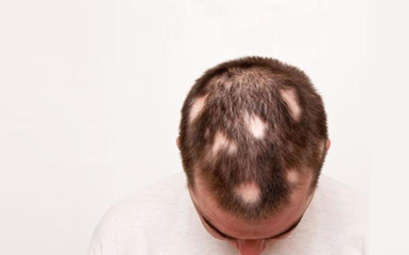 Saçkıran Duası Okunuşu Ve Anlamı